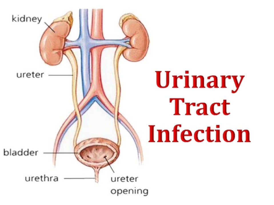 Can urinary tract spasms be a sign of a more serious condition?