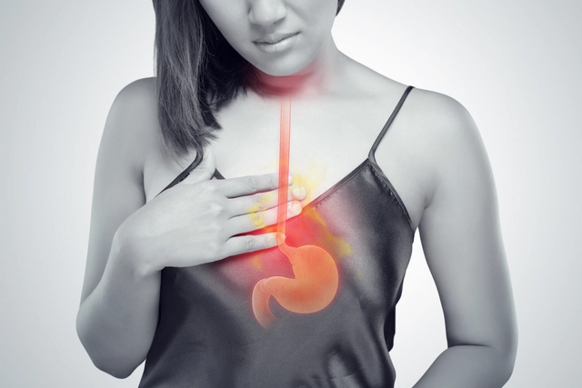 The Science behind Heartburn: What Happens in Your Body?